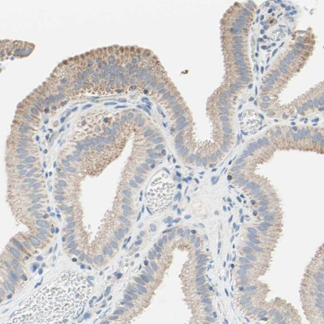 C2orf33 Antibody in Immunohistochemistry (IHC)