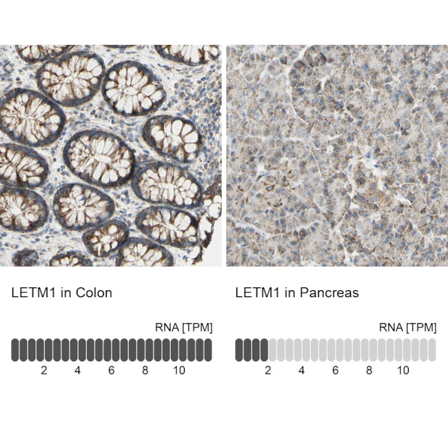 LETM1 Antibody in Immunohistochemistry (IHC)