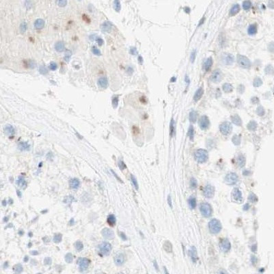 MANEA Antibody in Immunohistochemistry (IHC)