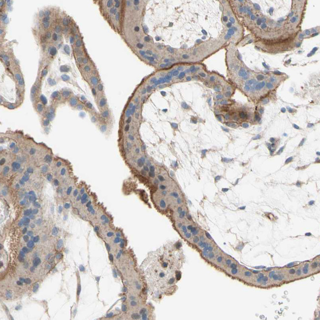 SEMA4C Antibody in Immunohistochemistry (IHC)