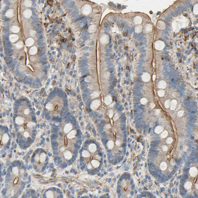 SEMA4C Antibody in Immunohistochemistry (IHC)