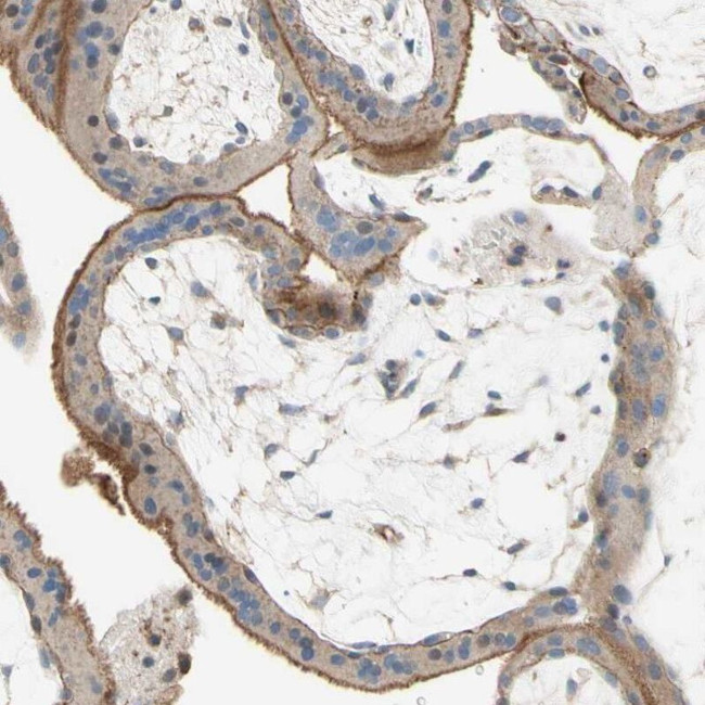 SEMA4C Antibody in Immunohistochemistry (IHC)