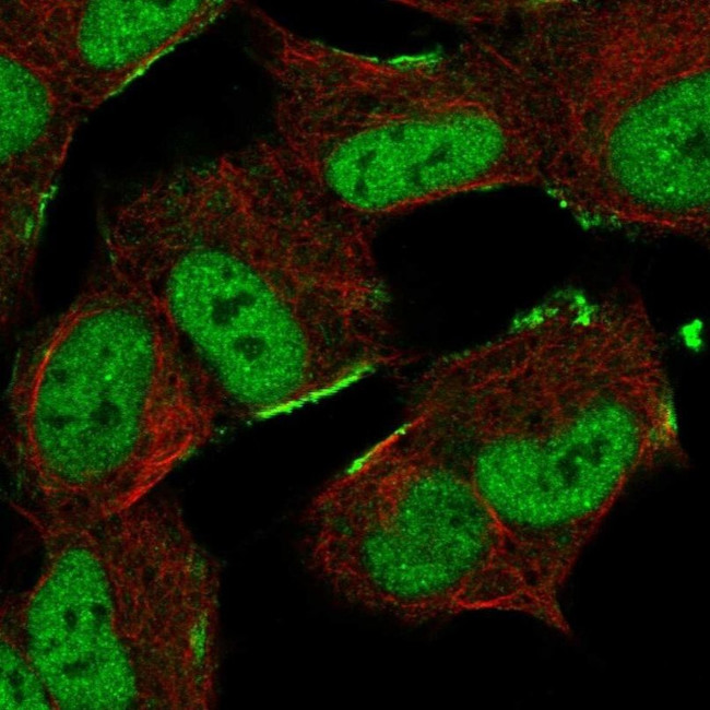 ZNF690 Antibody in Immunocytochemistry (ICC/IF)