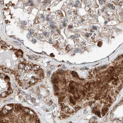 ZNF690 Antibody in Immunohistochemistry (IHC)