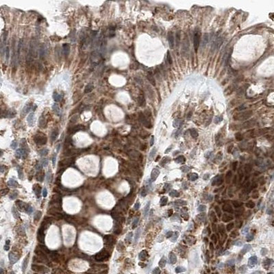 ZNF690 Antibody in Immunohistochemistry (IHC)