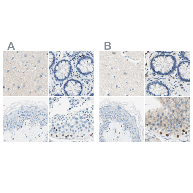 PASD1 Antibody in Immunohistochemistry (IHC)