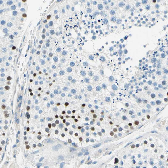 PASD1 Antibody in Immunohistochemistry (IHC)