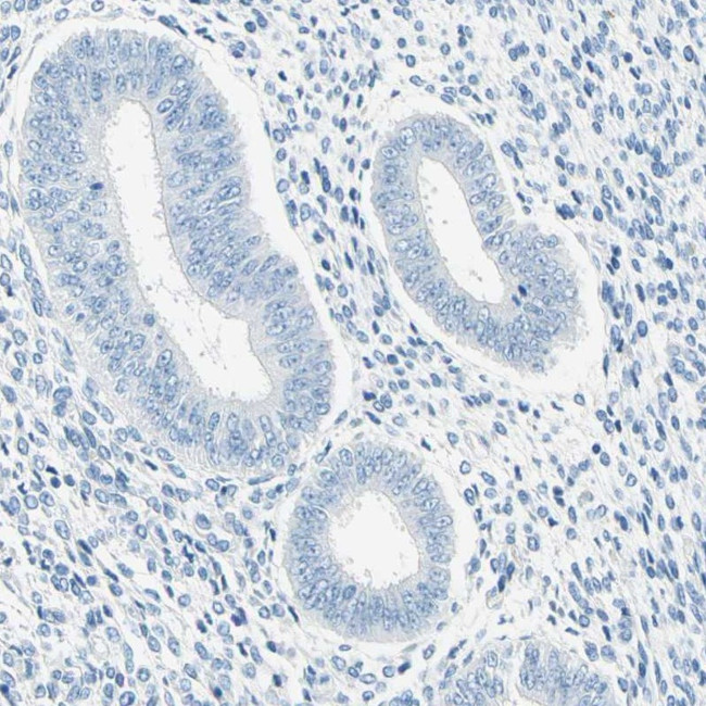 PASD1 Antibody in Immunohistochemistry (IHC)