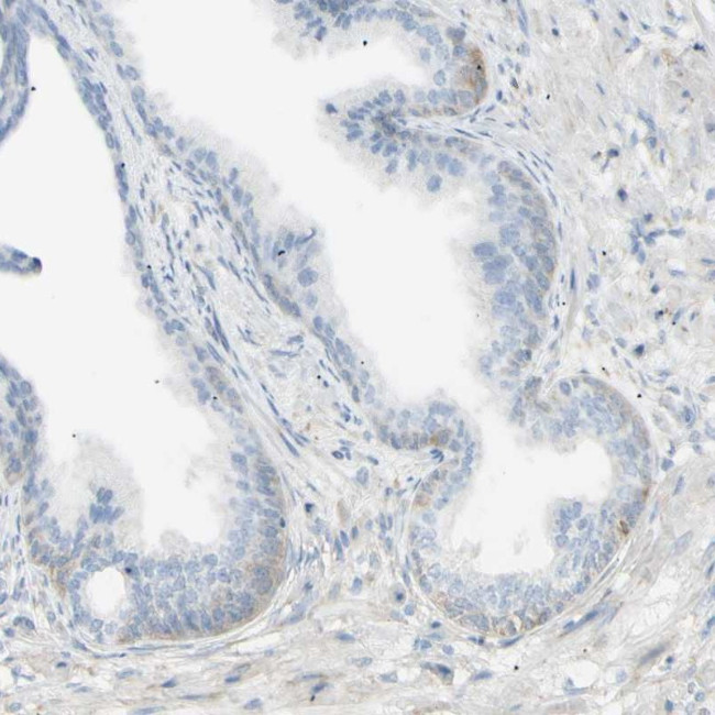 GALNTL5 Antibody in Immunohistochemistry (IHC)