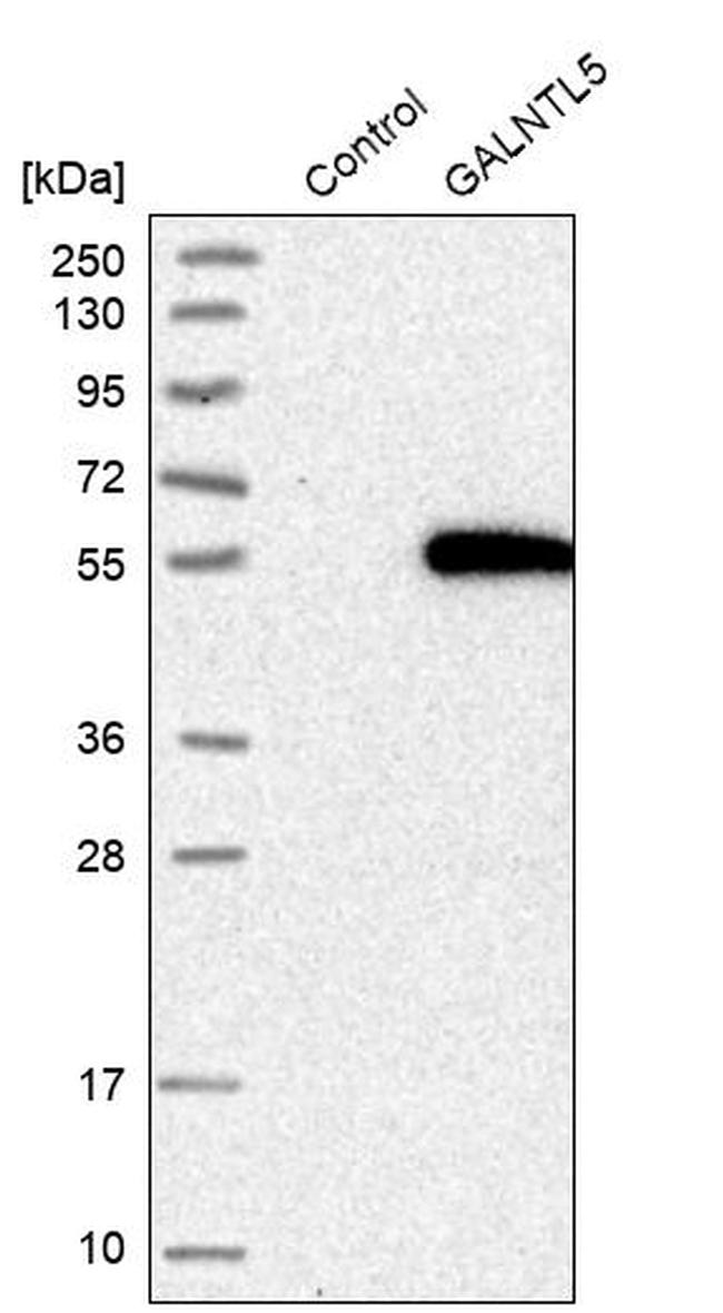 GALNTL5 Antibody in Western Blot (WB)