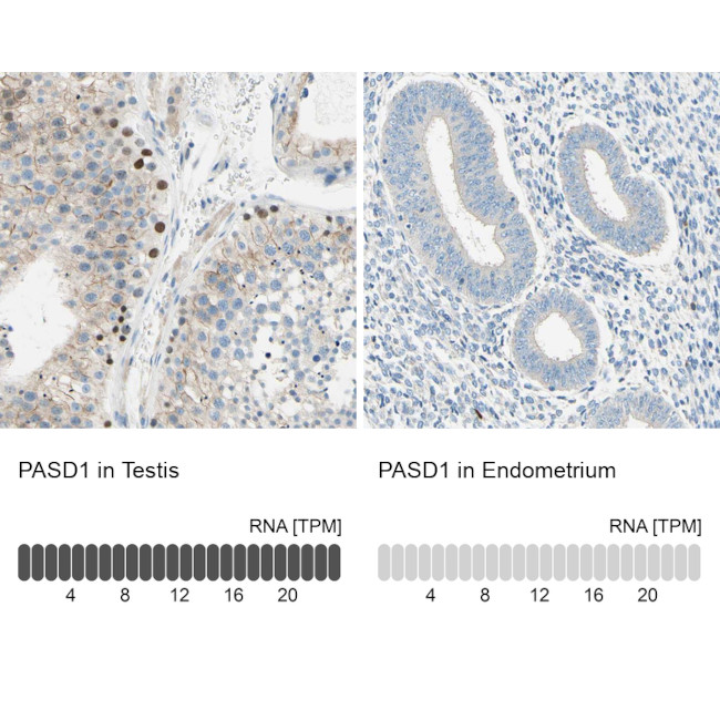 PASD1 Antibody in Immunohistochemistry (IHC)