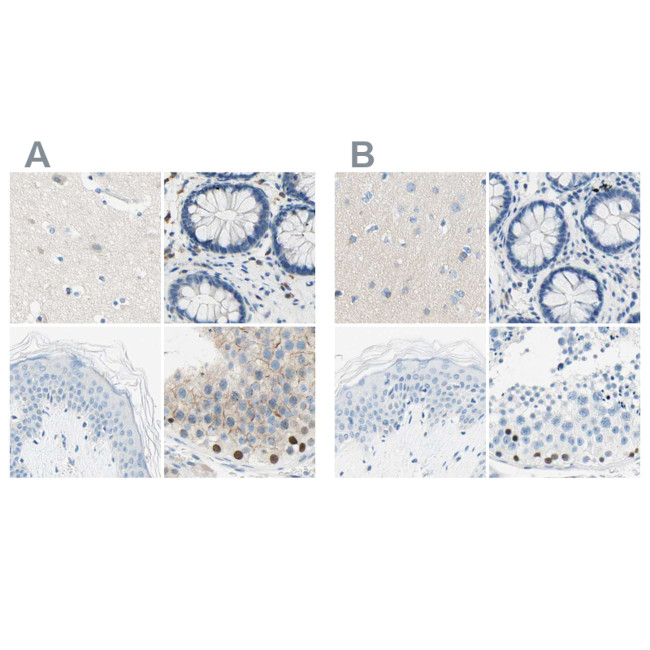 PASD1 Antibody in Immunohistochemistry (IHC)