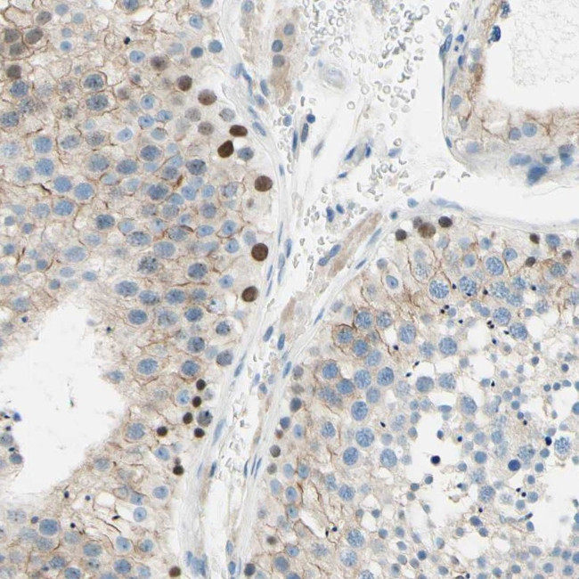 PASD1 Antibody in Immunohistochemistry (IHC)