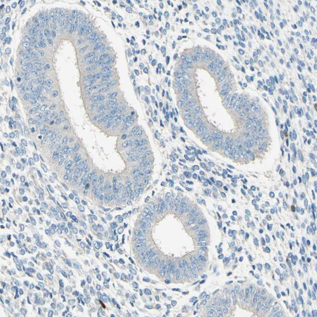 PASD1 Antibody in Immunohistochemistry (IHC)