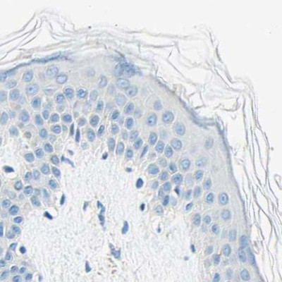 PASD1 Antibody in Immunohistochemistry (IHC)