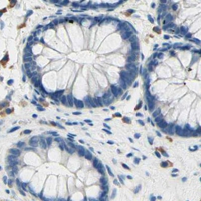 PASD1 Antibody in Immunohistochemistry (IHC)