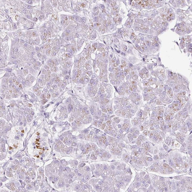 SDF4 Antibody in Immunohistochemistry (IHC)