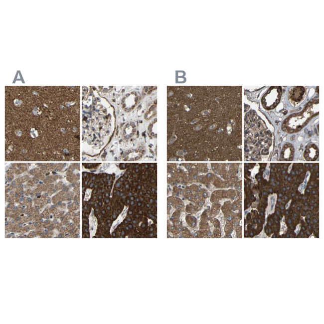 C1GALT1 Antibody in Immunohistochemistry (IHC)