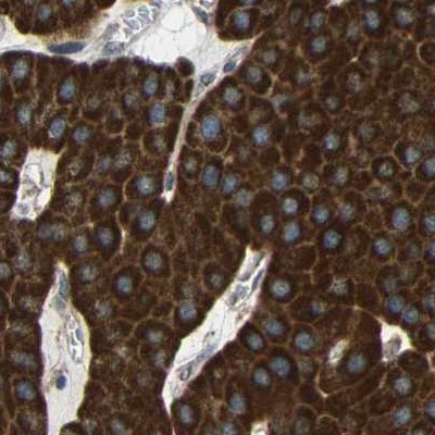 C1GALT1 Antibody in Immunohistochemistry (IHC)