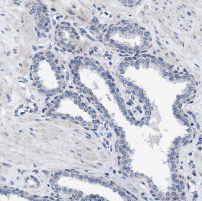 ZP2 Antibody in Immunohistochemistry (IHC)