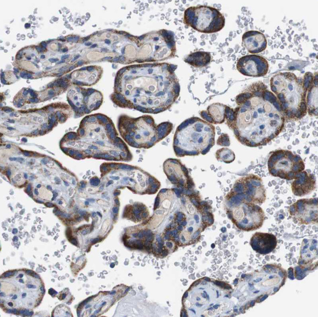 ZP2 Antibody in Immunohistochemistry (IHC)