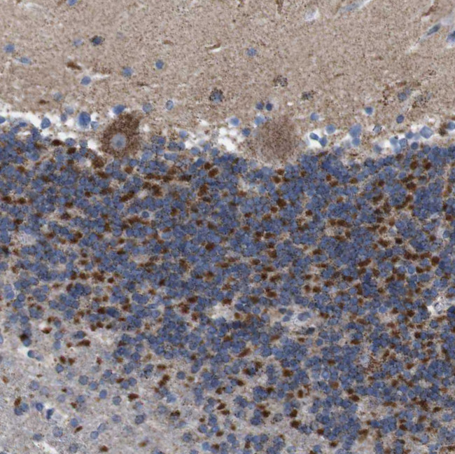 ZP2 Antibody in Immunohistochemistry (IHC)