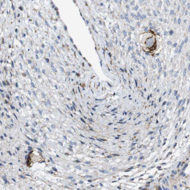 ZP2 Antibody in Immunohistochemistry (IHC)