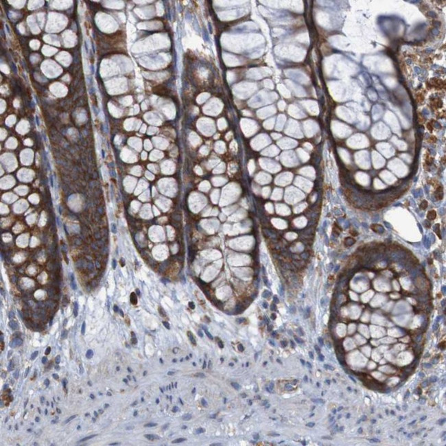 RPL10 Antibody in Immunohistochemistry (IHC)