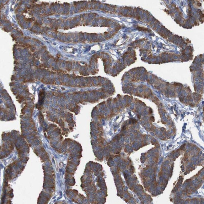 RPL10 Antibody in Immunohistochemistry (IHC)