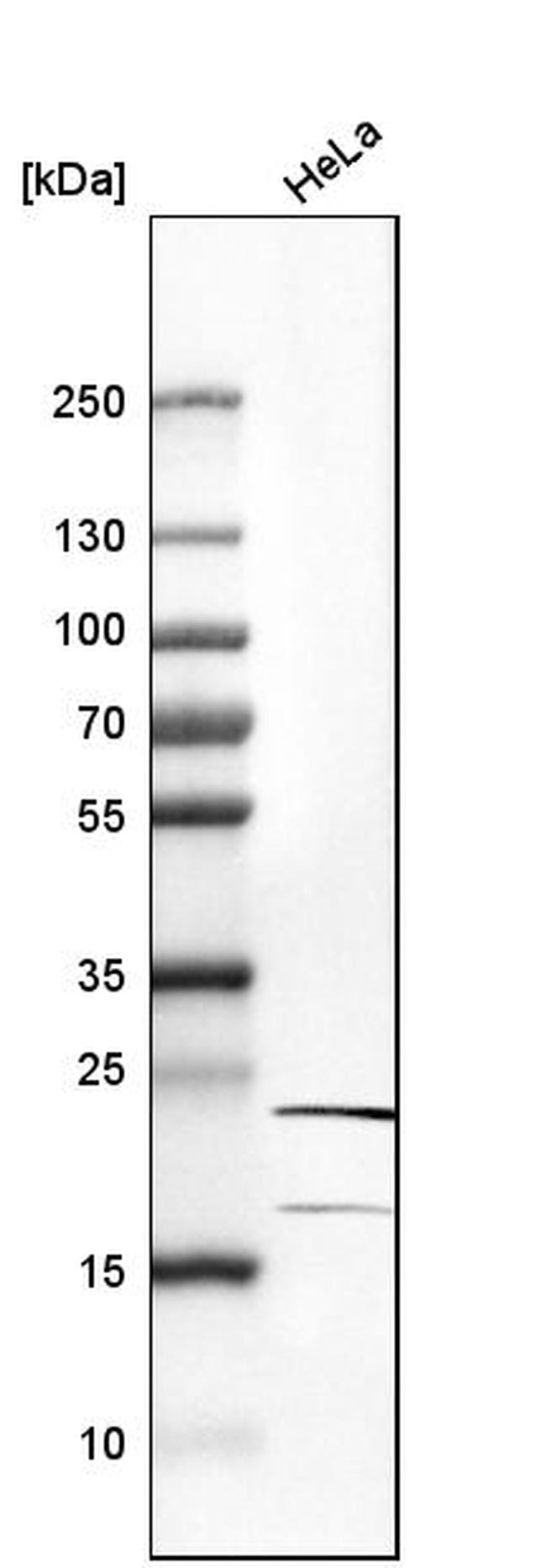 RPL10 Antibody in Western Blot (WB)