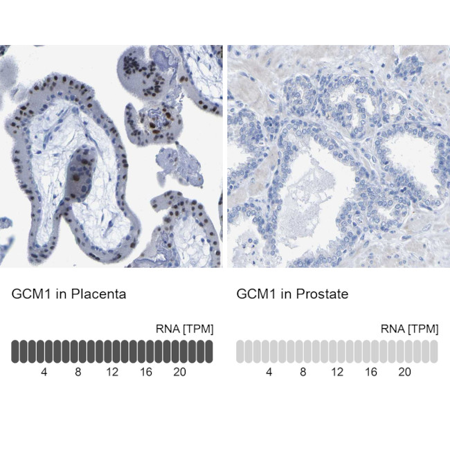 GCM1 Antibody