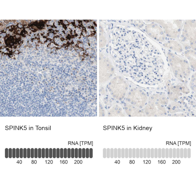 SPINK5 Antibody in Immunohistochemistry (IHC)