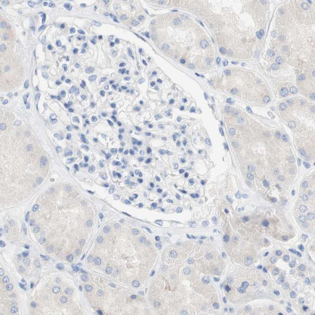 SPINK5 Antibody in Immunohistochemistry (IHC)