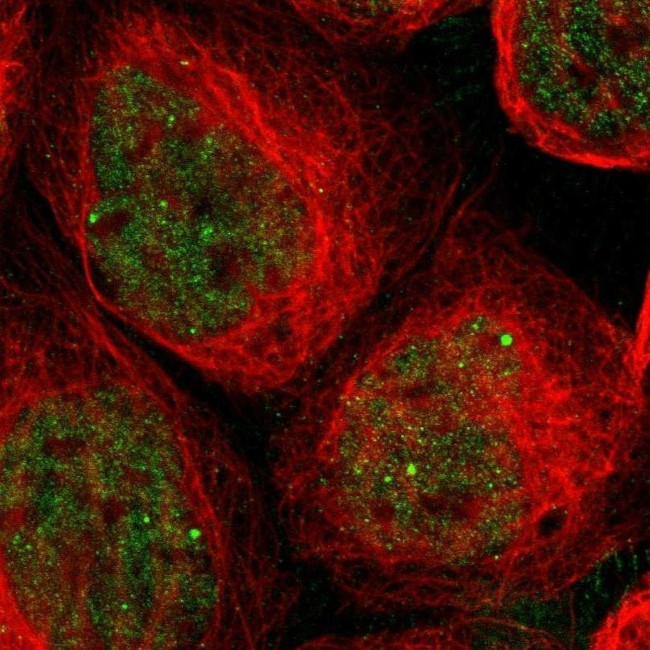 SAP18 Antibody in Immunocytochemistry (ICC/IF)