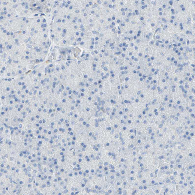 B4GALNT3 Antibody in Immunohistochemistry (IHC)