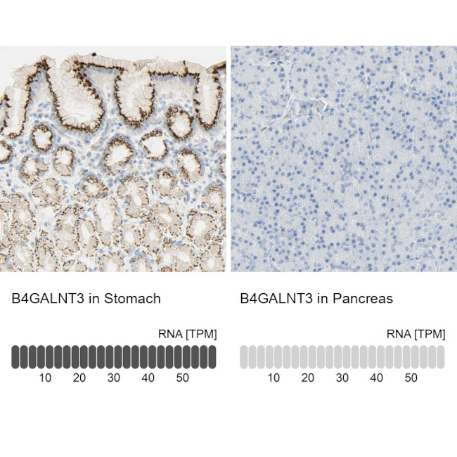 B4GALNT3 Antibody