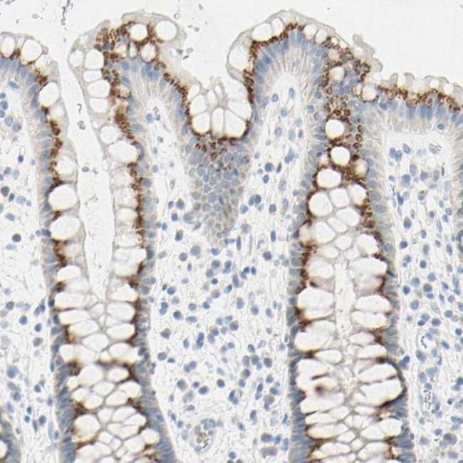 B4GALNT3 Antibody in Immunohistochemistry (IHC)