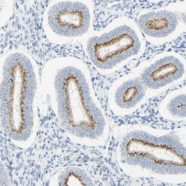 B4GALNT3 Antibody in Immunohistochemistry (IHC)