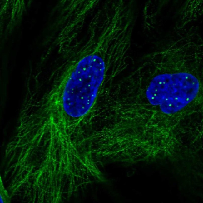 KCNE4 Antibody in Immunocytochemistry (ICC/IF)