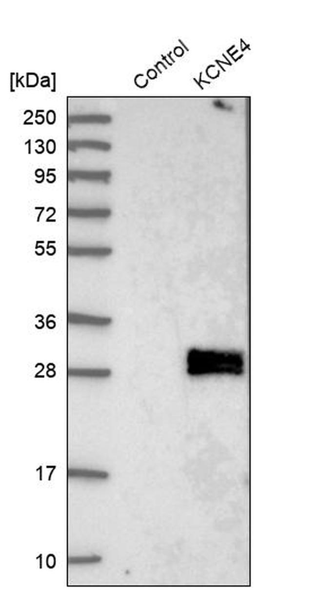 KCNE4 Antibody in Western Blot (WB)