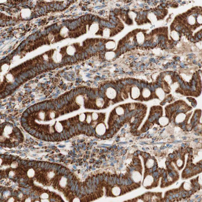 TOMM20 Antibody in Immunohistochemistry (IHC)