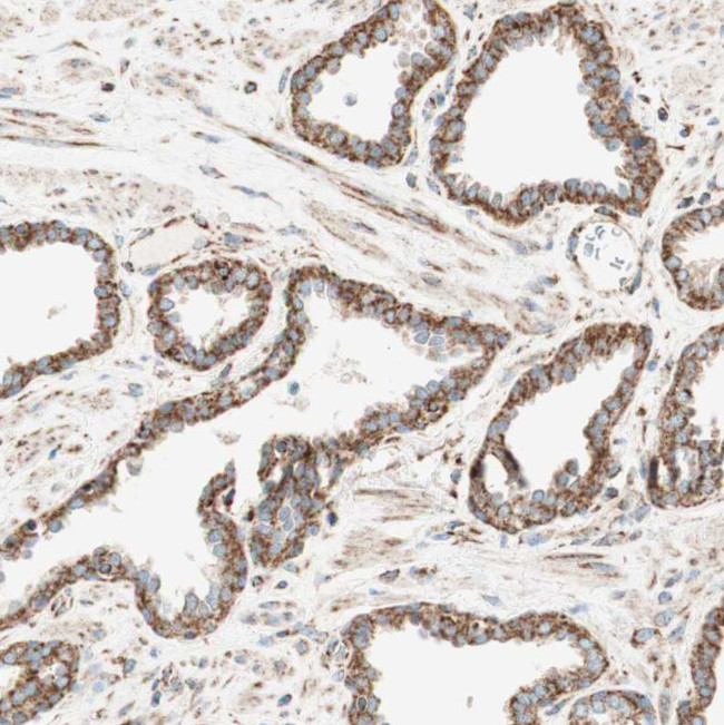 TOMM20 Antibody in Immunohistochemistry (IHC)