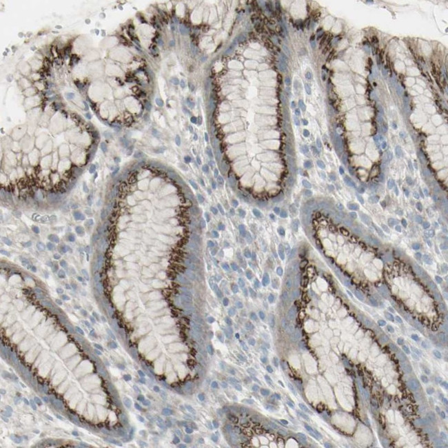 GALNT6 Antibody in Immunohistochemistry (IHC)