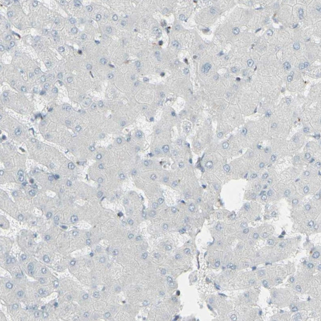 GALNT6 Antibody in Immunohistochemistry (IHC)