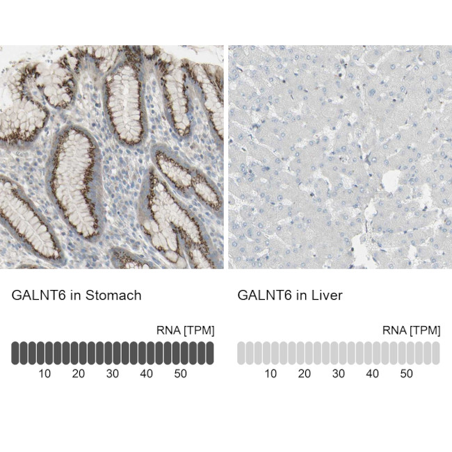 GALNT6 Antibody