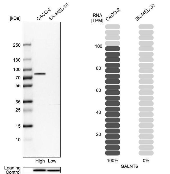 GALNT6 Antibody in Western Blot (WB)