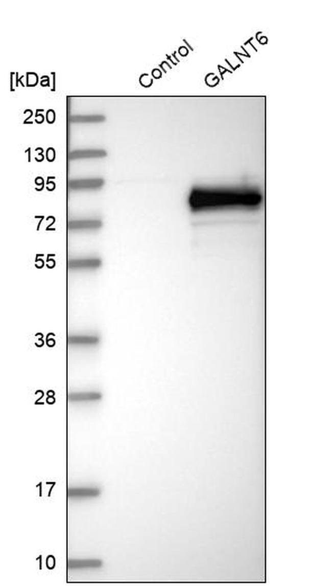 GALNT6 Antibody in Western Blot (WB)