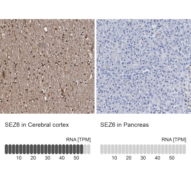 SEZ6 Antibody in Immunohistochemistry (IHC)