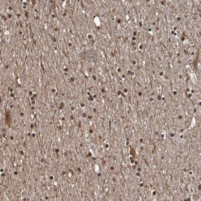 SEZ6 Antibody in Immunohistochemistry (IHC)