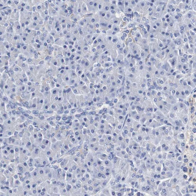 SEZ6 Antibody in Immunohistochemistry (IHC)